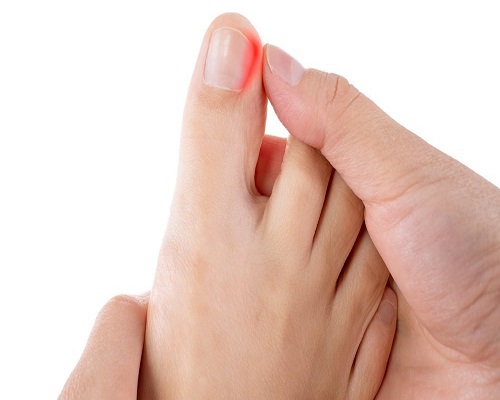 Stages of healing following toenail removal